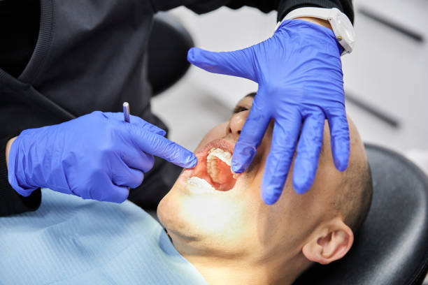 Best Emergency Dental Care for Trauma or Injury in Myers Corner, NY